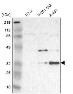 MNAT1 Antibody, Novus Biologicals 25 &mu;L; Unlabeled:Antibodies, Polyclonal